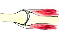 Figura 2. Manguito de los rotadores estabilizando la articulación del hombro