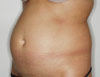 Abdomen_01