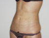 Abdomen_02