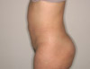 Abdomen_04