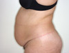 Abdomen_03