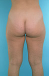 Nalgas_01