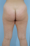 Nalgas_03