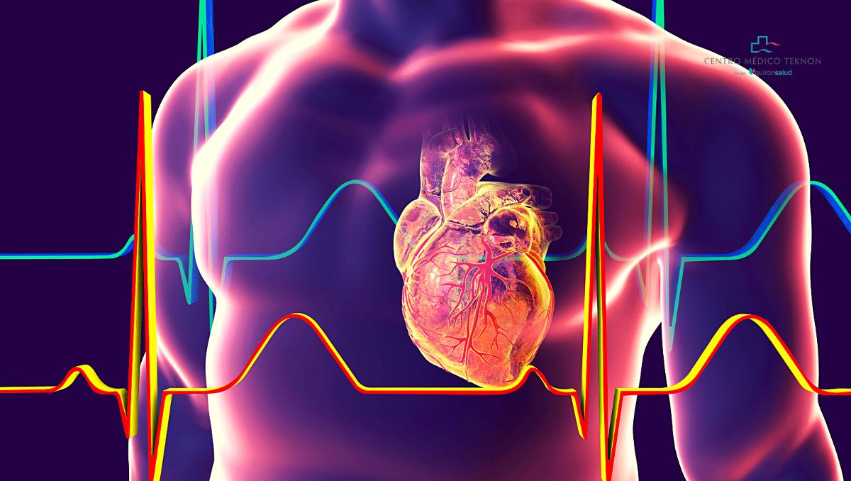 Fibrilación auricular: la arritmia cardiaca más frecuente y la que puede  tener peores consecuencias | Blog de Centro Médico Teknon