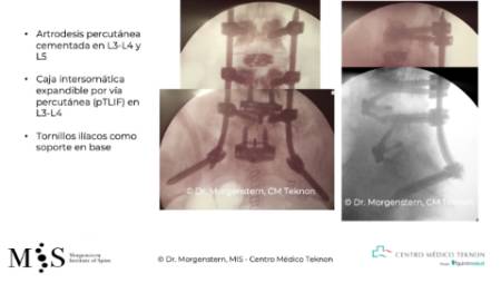 Diapositiva3