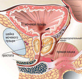 prostata_ru_3